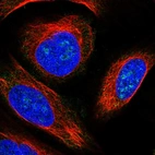 Immunofluorescent staining of human cell line U-2 OS shows localization to nucleoli.