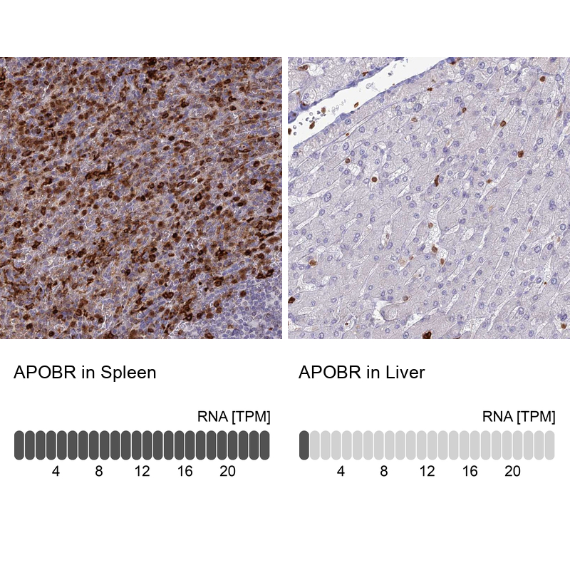 Anti-APOBR Antibody