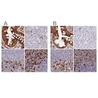 Immunohistochemical staining of human colon, liver, lymph node and spleen using Anti-APOBR antibody HPA041667 (A) shows similar protein distribution across tissues to independent antibody HPA042093 (B).