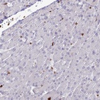 Immunohistochemical staining of human liver shows low expression as expected.
