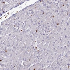 Immunohistochemical staining of human liver shows low expression as expected.