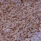 Immunohistochemical staining of human spleen shows high expression.