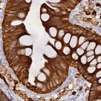 Immunohistochemical staining of human colon using Anti-APOBR antibody HPA041667.
