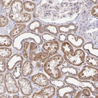 Anti-GINM1 Antibody