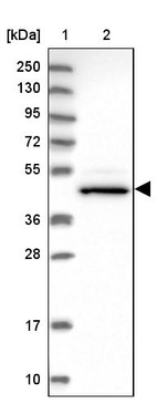 Lane 1: Marker [kDa] 250, 130, 95, 72, 55, 36, 28, 17, 10_br/_Lane 2: Human cell line RT-4