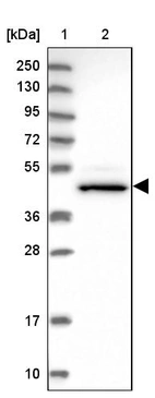 Lane 1: Marker [kDa] 250, 130, 95, 72, 55, 36, 28, 17, 10_br/_Lane 2: Human cell line RT-4