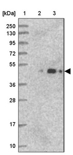 Anti-ARMC6 Antibody