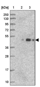 Lane 1: Marker [kDa] 250, 130, 95, 72, 55, 36, 28, 17, 10_br/_Lane 2: Human cell line RT-4_br/_Lane 3: Human cell line U-251MG sp