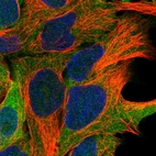 Immunofluorescent staining of human cell line HEK 293 shows localization to cytosol.