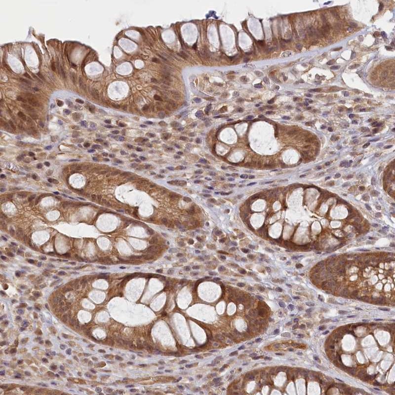 Anti-C19orf44 Antibody