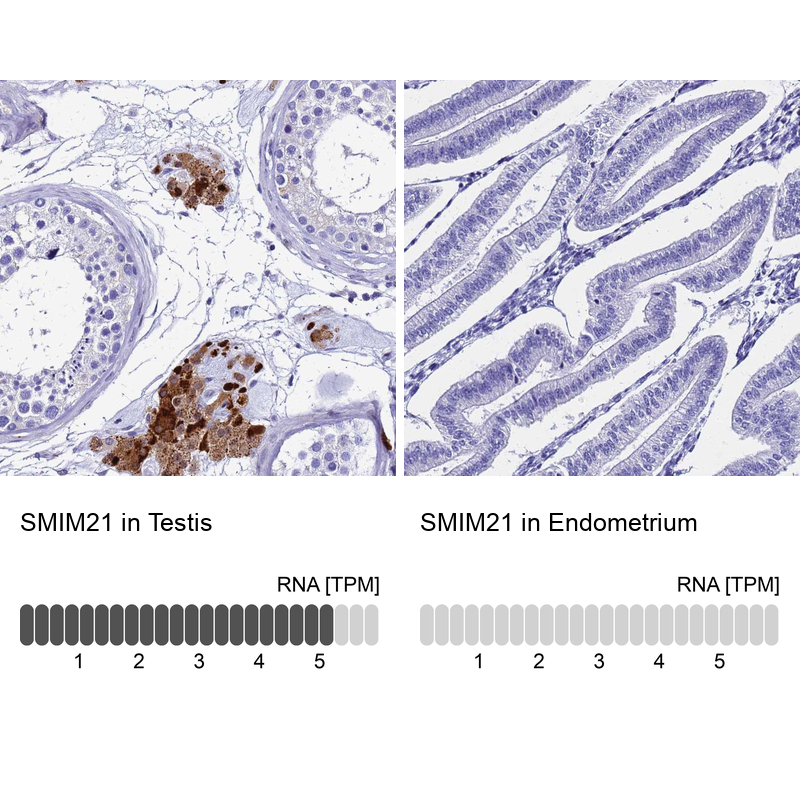Anti-SMIM21 Antibody