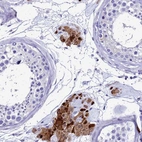 Immunohistochemical staining of human testis shows high expression.