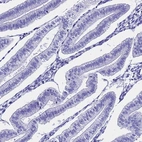 Immunohistochemical staining of human endometrium shows low expression as expected.