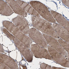 Immunohistochemical staining of human skeletal muscle shows strong cytoplasmic positivity in myocytes.