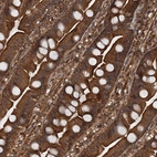 Immunohistochemical staining of human small intetstine shows strong cytoplasmic positivity in glandular cells.