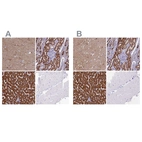 Immunohistochemical staining of human cerebral cortex, kidney, liver and skeletal muscle using Anti-ABAT antibody HPA041690 (A) shows similar protein distribution across tissues to independent antibody HPA041528 (B).
