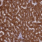 Immunohistochemical staining of human liver shows strong granular cytoplasmic positivity in hepatocytes.
