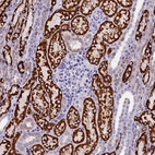 Immunohistochemical staining of human kidney shows strong granular cytoplasmic positivity in cells in tubules.