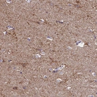 Immunohistochemical staining of human cerebral cortex shows moderate positivity in neuropil.