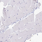 Immunohistochemical staining of human skeletal muscle shows no positivity in myocytes as expected.