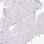 Immunohistochemical staining of human skeletal muscle shows no positivity in myocytes as expected.