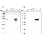 Western blot analysis using Anti-ABAT antibody HPA041690 (A) shows similar pattern to independent antibody HPA041528 (B).