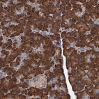 Anti-RGS11 Antibody