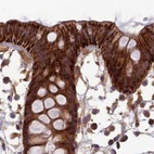 Immunohistochemical staining of human colon using Anti-TCF25 antibody HPA041699.