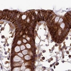 Immunohistochemical staining of human colon using Anti-TCF25 antibody HPA041699.