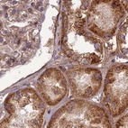 Immunohistochemical staining of human kidney using Anti-TCF25 antibody HPA041699.