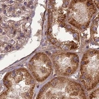 Immunohistochemical staining of human kidney using Anti-TCF25 antibody HPA041699.