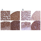 Immunohistochemical staining of human colon, liver, small intestine and spleen using Anti-BLVRB antibody HPA041698 (A) shows similar protein distribution across tissues to independent antibody HPA041937 (B).