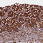 Immunohistochemical staining of human small intestine shows moderate to strong cytoplasmic positivity in glandular cells.
