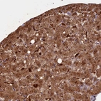 Immunohistochemical staining of human liver shows moderate to strong cytoplasmic positivity in hepatocytes.