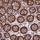 Immunohistochemical staining of human colon shows moderate to strong cytoplasmic positivity in glandular cells.
