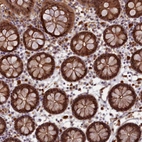 Immunohistochemical staining of human colon shows moderate to strong cytoplasmic positivity in glandular cells.