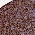 Immunohistochemical staining of human spleen shows moderate to strong cytoplasmic positivity in cells in red pulp.