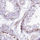 Anti-CMTR2 Antibody