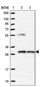 Lane 1: Marker [kDa] 250, 130, 95, 72, 55, 36, 28, 17, 10_br/_Lane 2: Human cell line RT-4_br/_Lane 3: Human cell line U-251MG sp