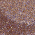 Immunohistochemical staining of human tonsil shows moderate cytoplasmic positivity in germinal and non-germinal center cells.