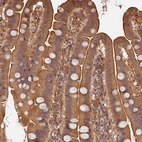 Immunohistochemical staining of human small intestine shows moderate cytoplasmic positivity in glandular cells.