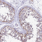 Immunohistochemical staining of human testis shows moderate granular cytoplasm positivity in cells in seminiferous ducts.