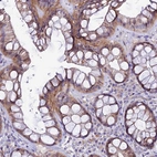 Immunohistochemical staining of human rectum hows moderate granular cytoplasm positivity in glandular cells.