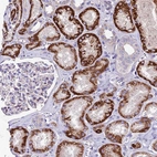 Immunohistochemical staining of human kidney shows strong granular cytoplasm positivity in cells in tubules.