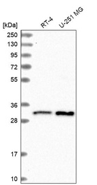 Western blot analysis in human cell line RT-4 and human cell line U-251 MG.