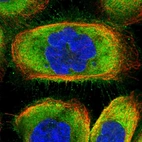 Immunofluorescent staining of human cell line A-431 shows localization to plasma membrane & cytosol.