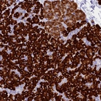 Immunohistochemical staining of human pancreas shows strong cytoplasmic positivity in exocrine glandular cells.