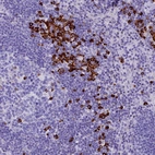 Immunohistochemical staining of human lymph node shows strong cytoplasmic positivity in non-germinal center cells.