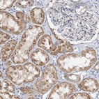 Anti-ZNF606 Antibody