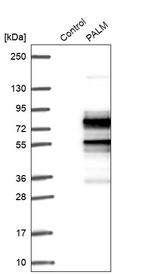 Western blot analysis in control (vector only transfected HEK293T lysate) and PALM over-expression lysate (Co-expressed with a C-terminal myc-DDK tag (~3.1 kDa) in mammalian HEK293T cells, LY419238).